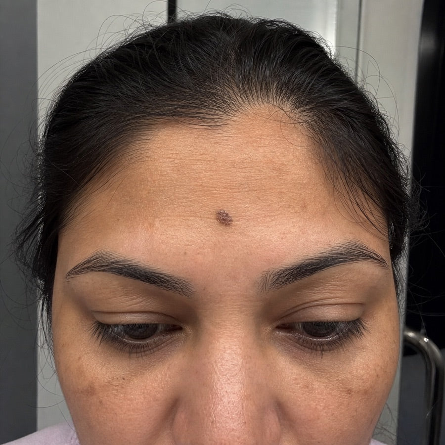 Priya progress photo