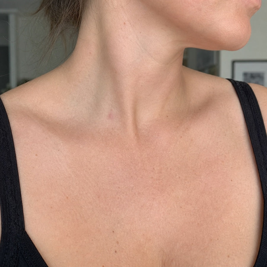Claire progress photo